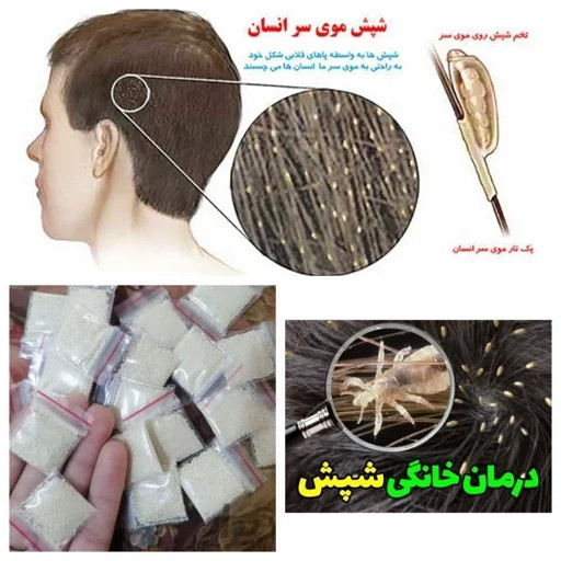 پودر شپش اصلی عراقی
